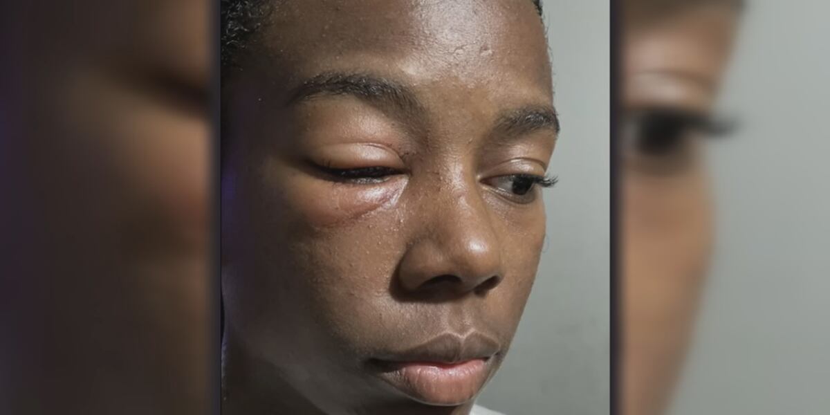 Mom says daughter was ambushed in school prank